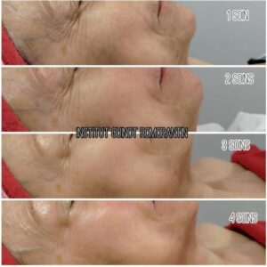 SOIN VISIBLE AGE REVERSE